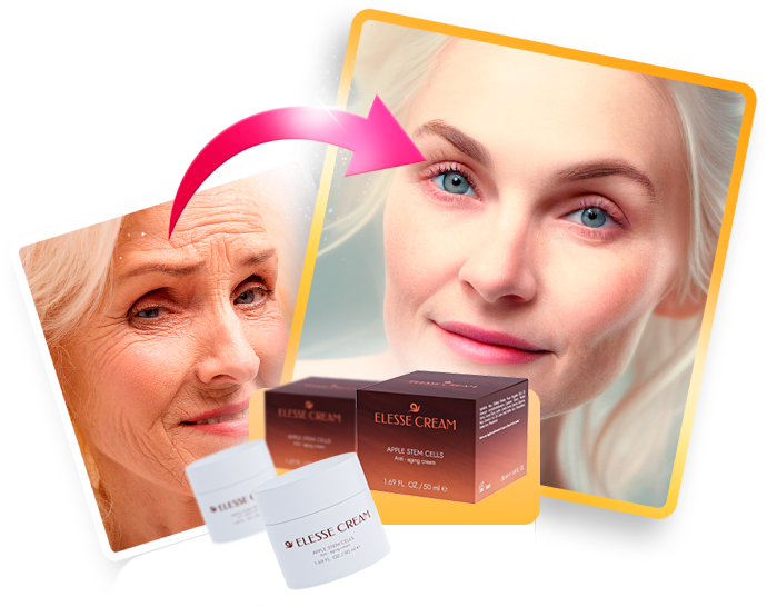 Elesse Cream